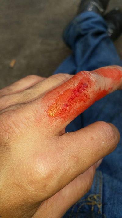 手腕流血真实照片